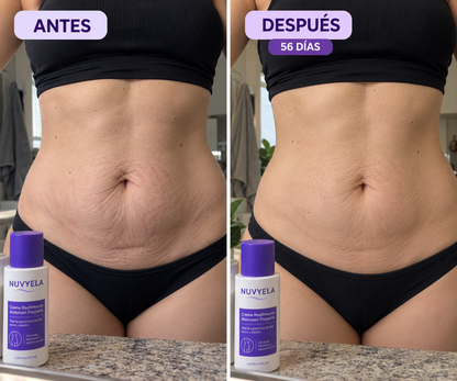 Nuvyela® Crema Reafirmante para Abdomen Posparto